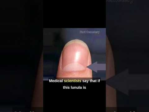 The Lunula: Your Fingernails Secret Health Indicator! #facts #shorts