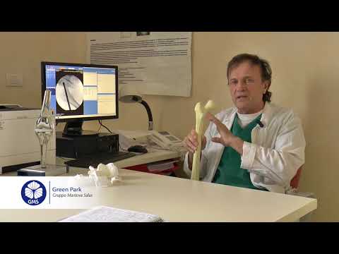 Mani dolori articolari e osteocondrosi cervicale Neurite dellarticolazione della spalla