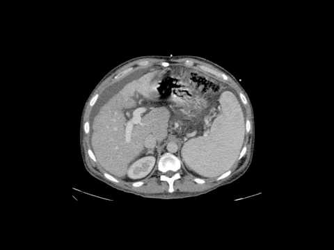 download lagu mp3 mp4 Tips Radiology, download lagu Tips Radiology gratis, unduh video klip Tips Radiology