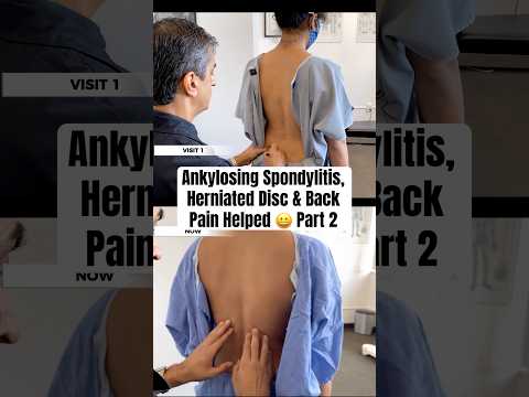 Back Pain, Neck Pain, Ankylosing Spondylitis — Relief 👏 | Dr. Rahim Compilation (Part 2)