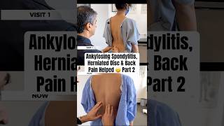 Back Pain, Neck Pain, Ankylosing Spondylitis — Relief 👏 | Dr. Rahim Compilation (Part 2)