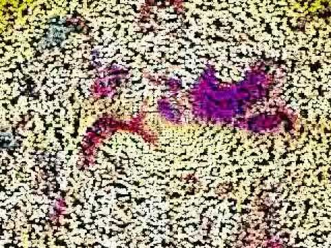 Sepe Miki Péye - No responde