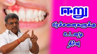 ஈறு பிரச்சனைகளுக்கு உடனடி தீர்வு | Mudra to get relief from Tooth Gum Problems (Tamil)