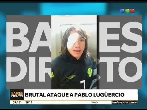 Le tiraron un piedrazo a un jugador de Aldosivi  - Telefe Noticias