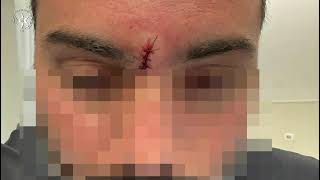 האזינו לשיחות למוקד המשטרה: “הוא רץ אחרינו עם גרזן”  (חדשות ערוץ 7) - התמונה מוצגת ישירות מתוך אתר האינטרנט יוטיוב. זכויות היוצרים בתמונה שייכות ליוצרה. קישור קרדיט למקור התוכן נמצא בתוך דף הסרטון