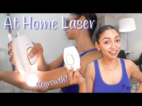 Laser Hair Removal at Home || Is is Effective? || My Review || Permanent Hair Removal
