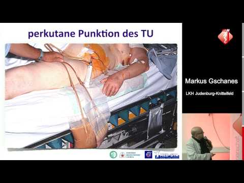 Fallbericht: Thoraxschmerz - Markus Gschanes