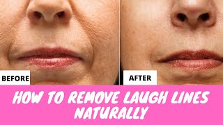 How to Get Rid of Laugh Lines | How to Remove Laugh Lines Naturally