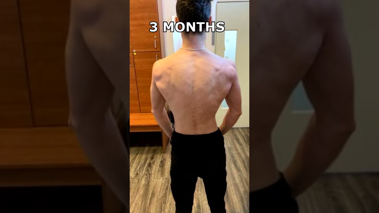 skinny to muscle - 1 year Natural BACK Transformation