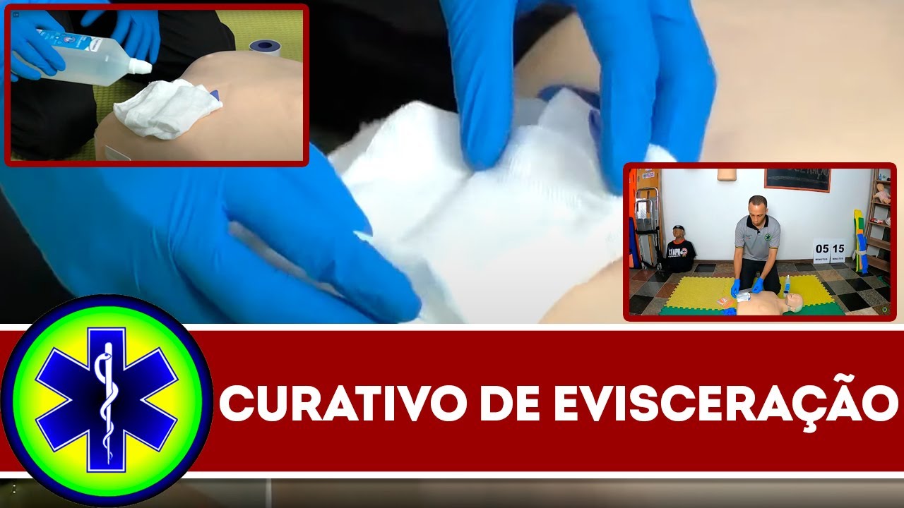 EVISCERAÇÃO no APH, como fazer o curativo? (APH e primeiros socorros)