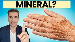 Download lagu BR.1 MINERAL koji UKLANJA staračke mrlje za 30 dana mp3 Download lagu BR.1 MINERAL koji UKLANJA staračke mrlje za 30 dana mp3