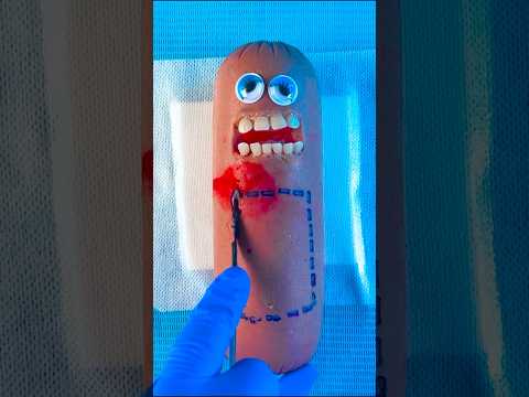 Why Do the End of these Food Surgeries Make Me Cry? 😭💔🤧