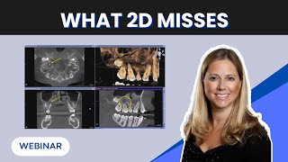 What You’re Missing Without CBCT
