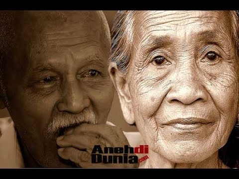 Alopecia dan potensi pada pria Penis kecil yang membutuhkannya
