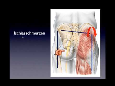 Kniegelenk Arthritis Behandlung der Volksmedizin Gutes Mittel, Osteochondrose