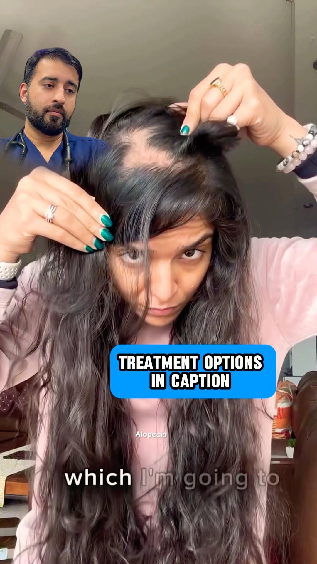 How to treat Alopecia hair loss