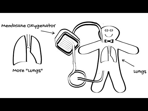 Introduction to ECMO Part 2 - V-V ECMO