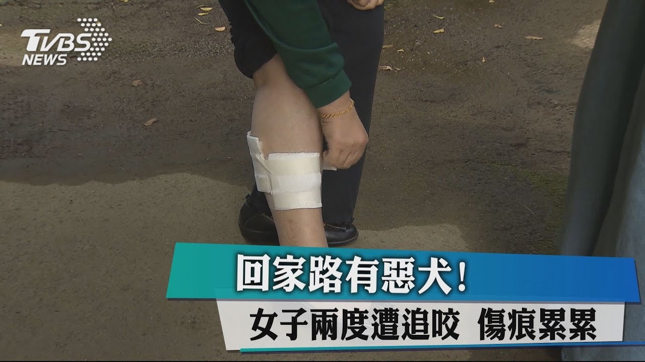 回家路有惡犬!女子兩度遭追咬 傷痕累累