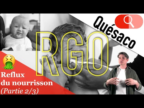 🤮 GERD or gastroesophageal reflux in breastfed and bottle-fed babies: Infant reflux 2/3