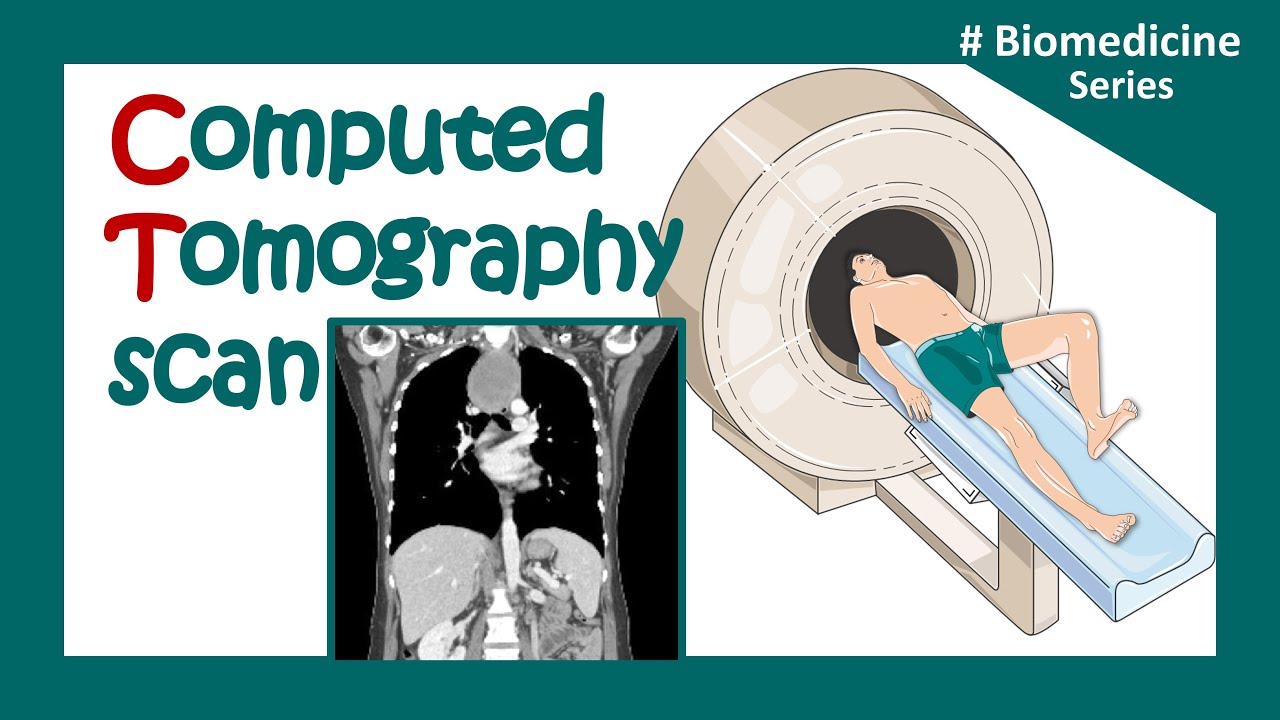CT scan | computerized tomography (CT) scan |What is a CT scan used for? | Clinical application