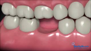 Best dental clinic In Udaipur