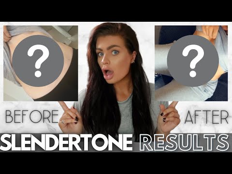 SLENDERTONE UPDATE - 6 Month Results - Before & After Pics