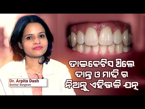 Know How Diabetes Affects Teeth And Gums