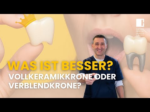 Die bessere Krone? Vollkeramik vs. Verblendung – so triffst du die richtige Entscheidung!