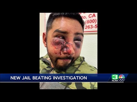 San Joaquin County sheriff launches protocol investigation after jail beating claim