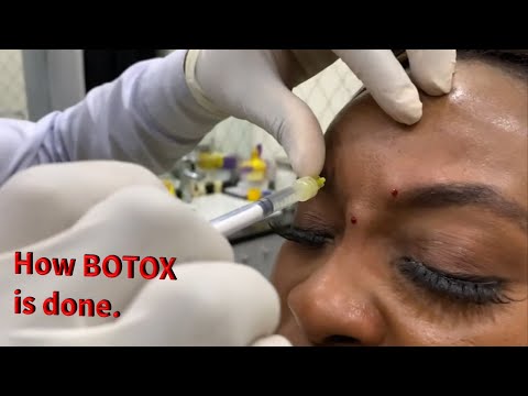 Botox Nigeria