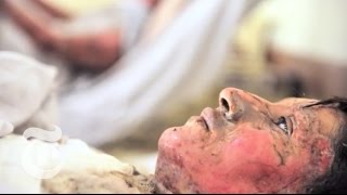 World: Burning Desperation | The New York Times