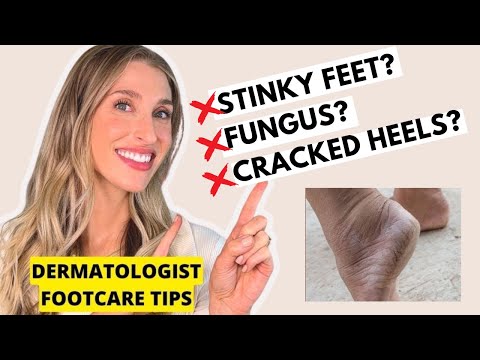 Toe Nail Fungus - Natural Remedies that WORK