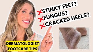 Dermatologist Footcare Tips for Toenail Fungus, Cracked Heels, Smelly Feet, & More | Dr. Sam Ellis