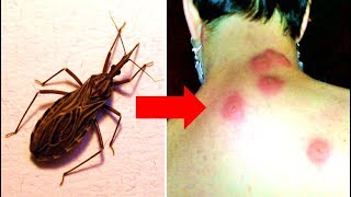 If You Spot One Of These Bugs In Your Home, Get Rid Of It Immediately