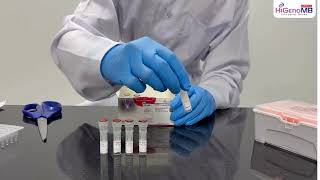 MBPCR181 - Hi‐PCR® Hepatitis B Virus (HBV) Detection and Quantitation Probe PCR Kit.