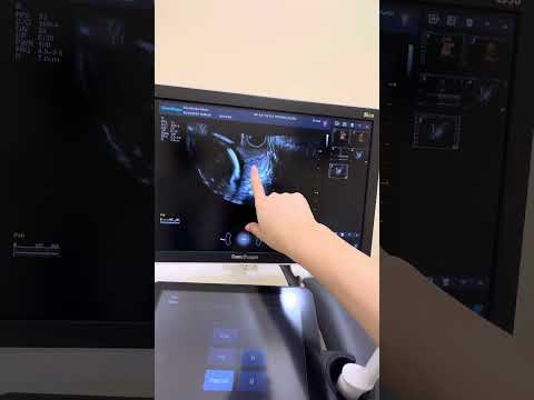 Katta sroklardagi ugroza xavfi#shorts#shortvideo#dopler#3d#uzi