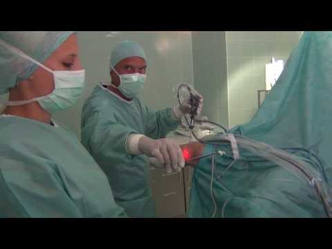 Als Rückenschmerzen, wenn Tumoren Arten von Knieersatz-Implantaten
