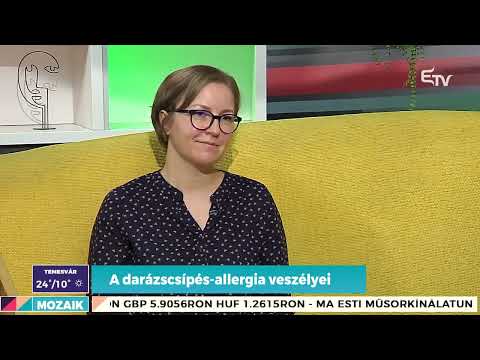 A darázscsípés-allergia veszélyei – Rendelő a Mozaikban