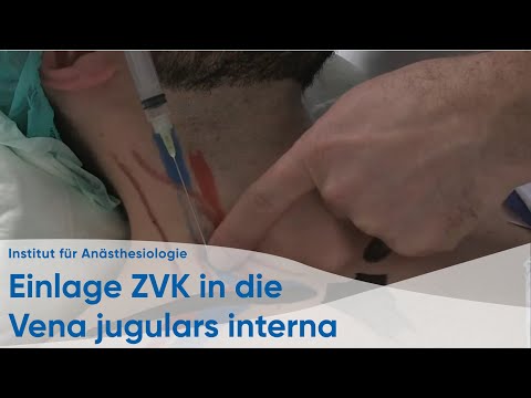 Die Einlage eines zentralen Venenkatheters in die Vena jugulars interna