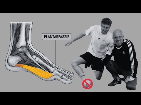 So geht's - Fersensporn und Plantarfasziitis in den Griff bekommen🦶