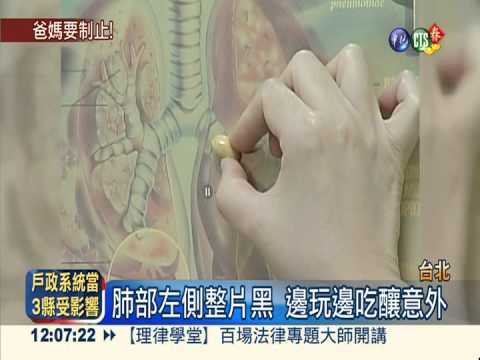 邊跑邊吃糖卡氣管 童肺炎險送命