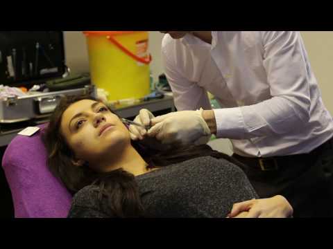 Cheek and Tear Trough Fillers Treatment Demonstration with Juvederm
