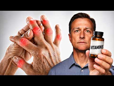 The #1 Best Vitamin for Arthritis (NOT VITAMIN D)