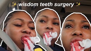 i got all my wisdom teeth taken out... (vlog)