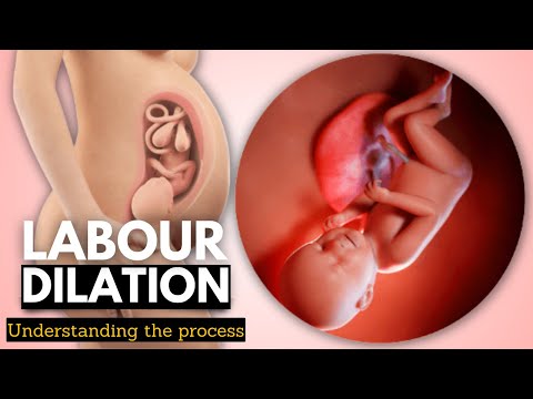 Hydrocephalus Causes Signs and Symptoms Diagnosis and Treatment