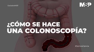 ¿Cómo se hace una colonoscopía #ExclusivoMSP