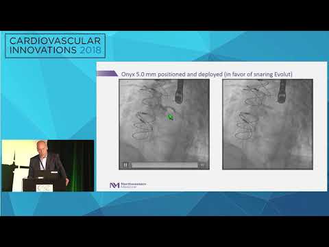 CVI2018 Session: How did this happen? - Mark Ricciardi, MD