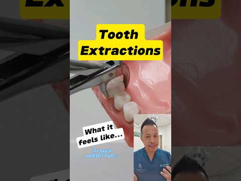 Preparing for Tooth Extraction: Does It Really Hurt? #shorts #dentallan #dentist