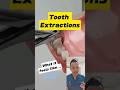 Preparing For Tooth Extraction Does It Really Hurt Shorts Dentallan Dentist