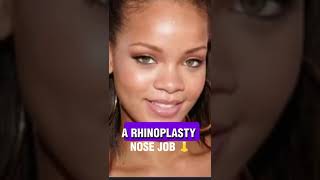 RIHANNA PLASTIC SURGERY RUMORS